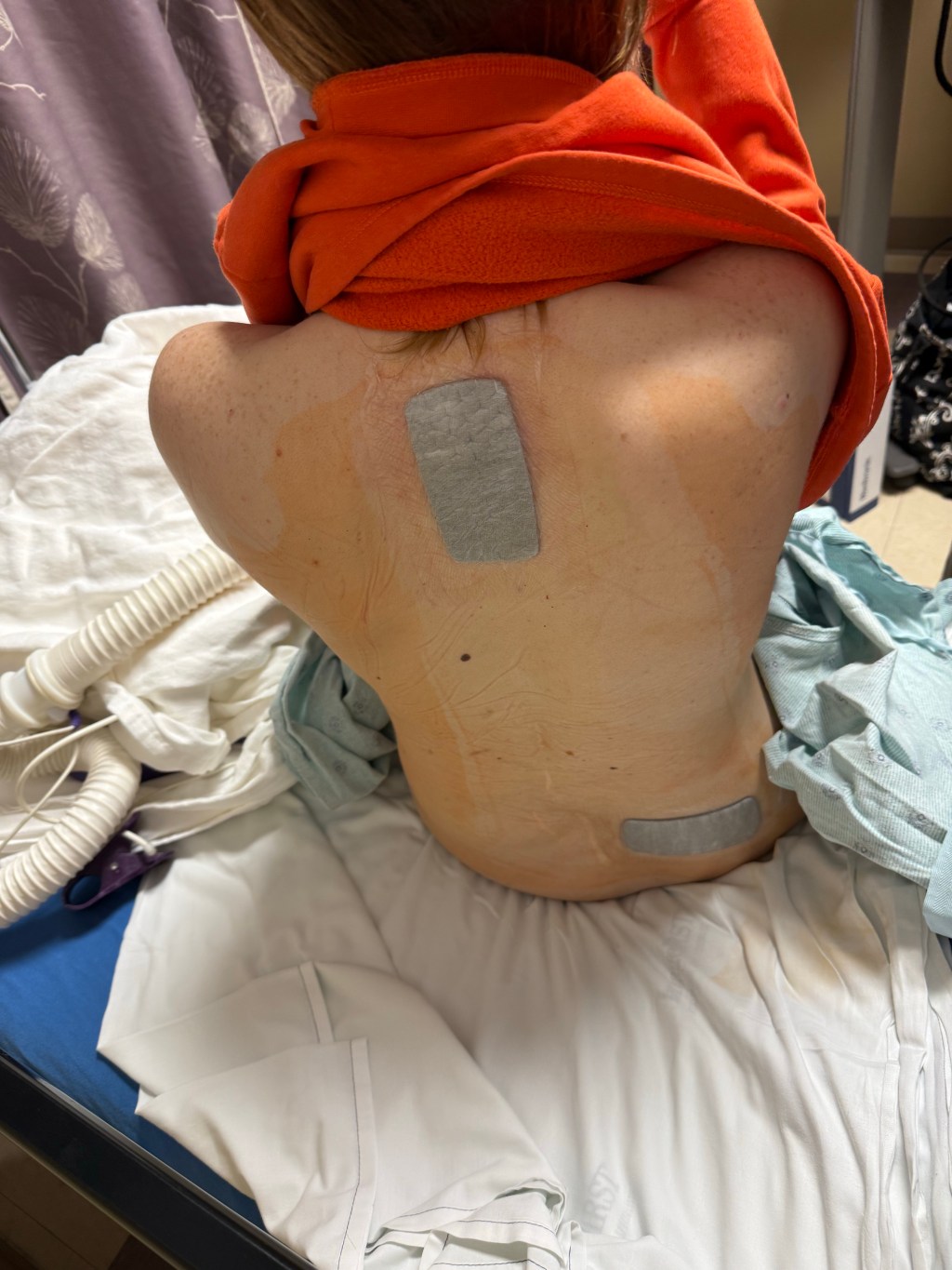 Surgery Update: I Survived, Barely… and My Kids Are Still Alive Too&nbsp;🎉