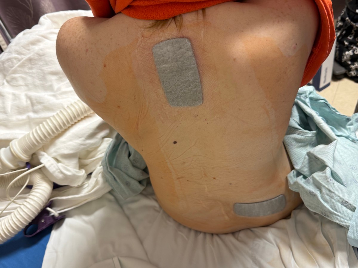 Surgery Day: An Unexpected&nbsp;Adventure